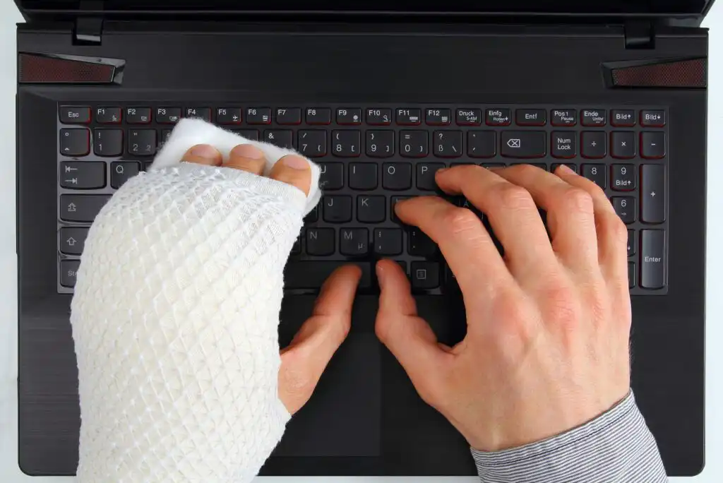 A person with a bandaged left hand types on a laptop keyboard, using only their right hand and the fingers of their injured left hand to press the keys.